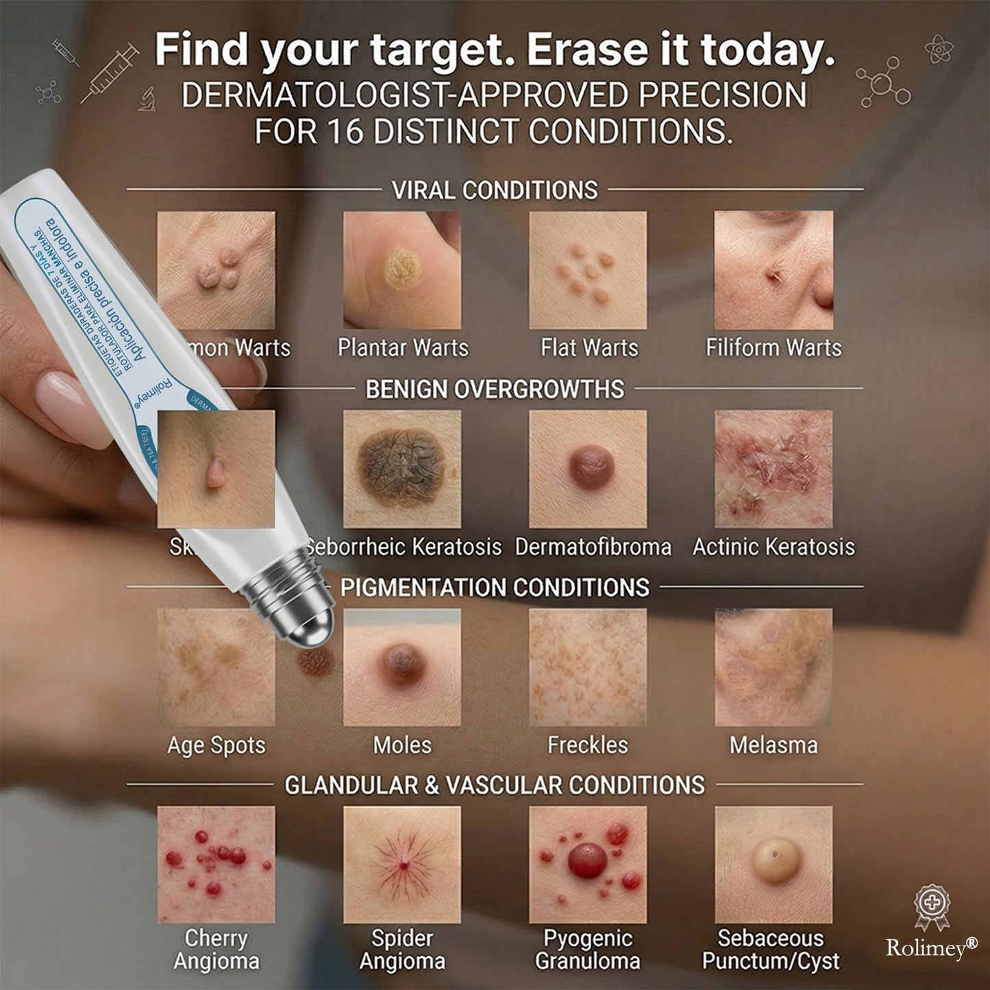 ✨ Official CAN Store | Natravor® 7-Day Skin Tag & Blemish Roll-On – Painless & Scar-Free