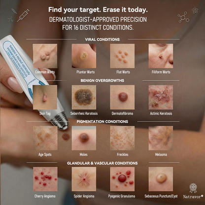 ✨ Official CAN Store | Natravor® 7-Day Skin Tag & Blemish Roll-On – Painless & Scar-Free