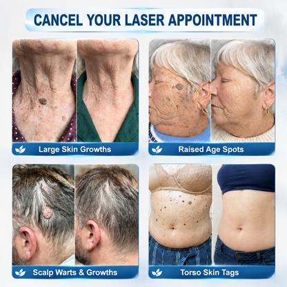 ✨ Official CAN Store | Natravor® 7-Day Skin Tag & Blemish Roll-On – Painless & Scar-Free
